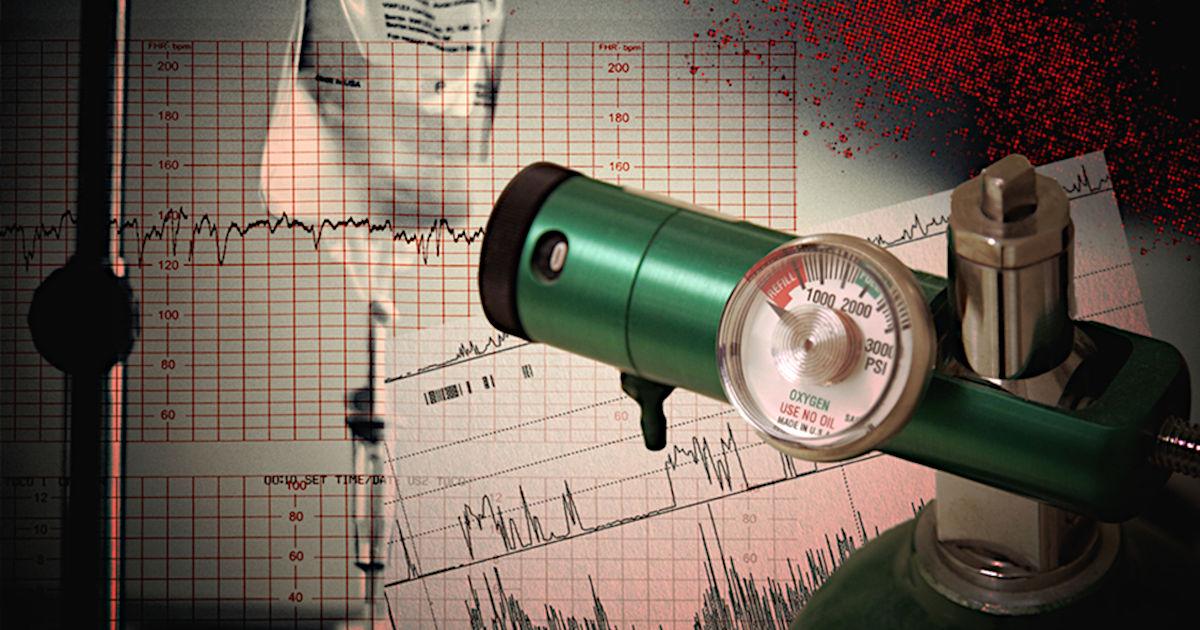 Choosing Patient Treatment Using Machine Learning Models