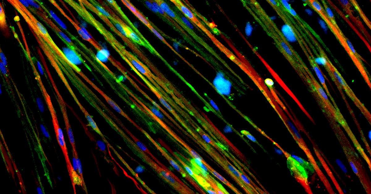 Therapeutic Research Advanced by Stem Cell Science