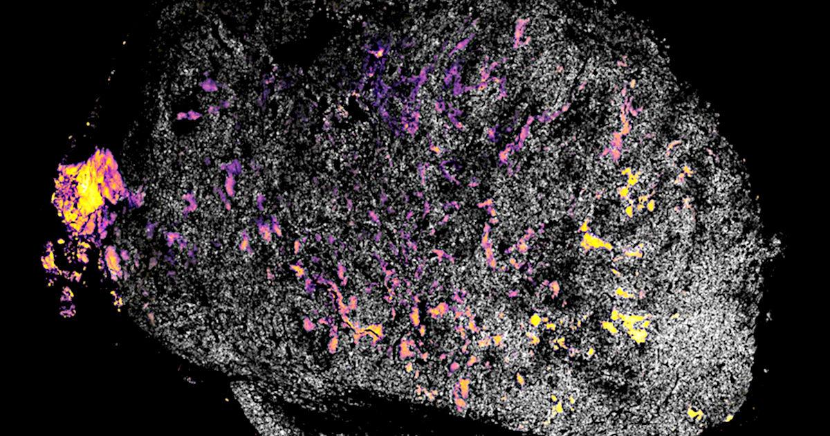 Two-Phase Immune System Stimulation to Treat Cancer