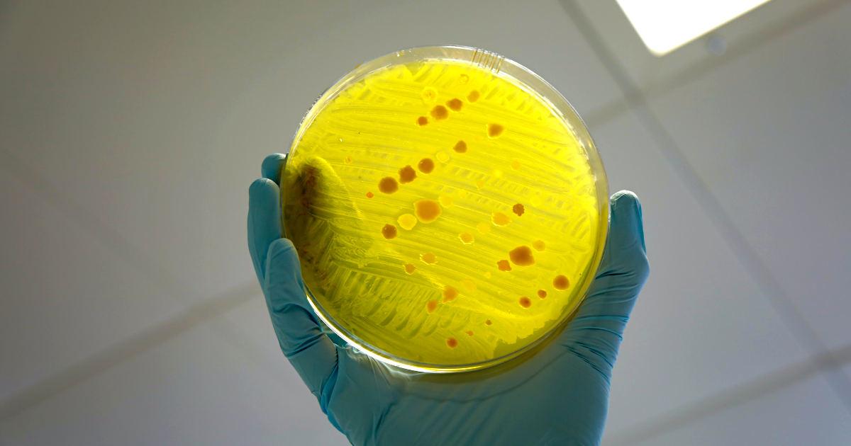 Novel Ways to Combat Antibiotic Resistance