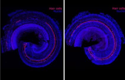 Stem Cell Solutions for Hearing Impairment and Multiple Sclerosis